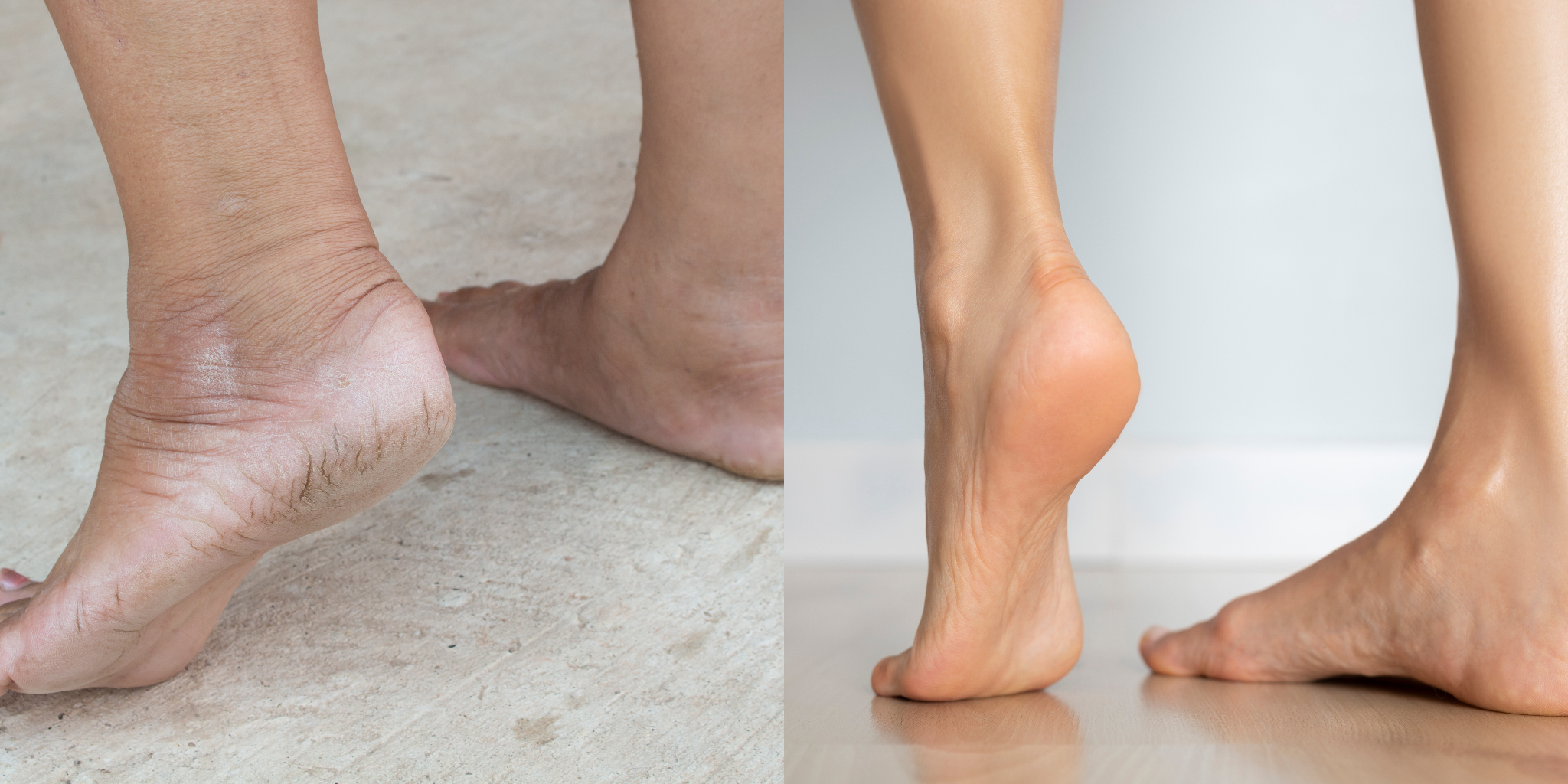 Well-groomed feet prepared and moisturized for photos
