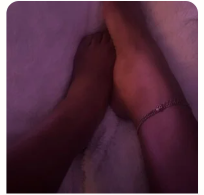 A dark, poorly lit foot photo example
