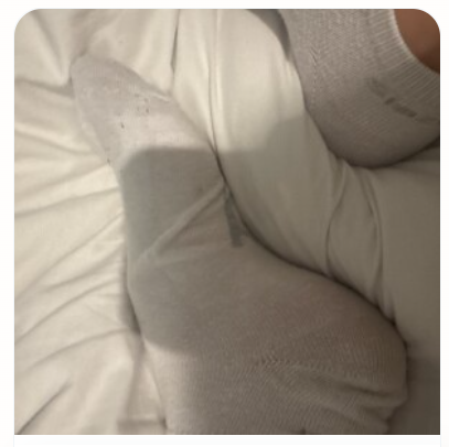 Dark, blurry foot photo